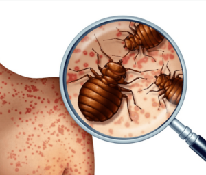 How-to-spot-bed-bugs